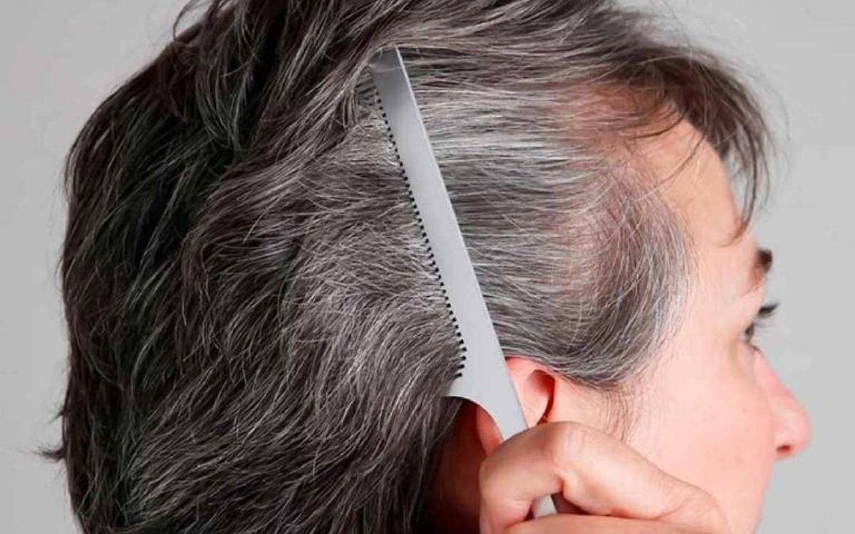 Độ tuổi trung niên thường đối mặt với việc bị rụng tóc
