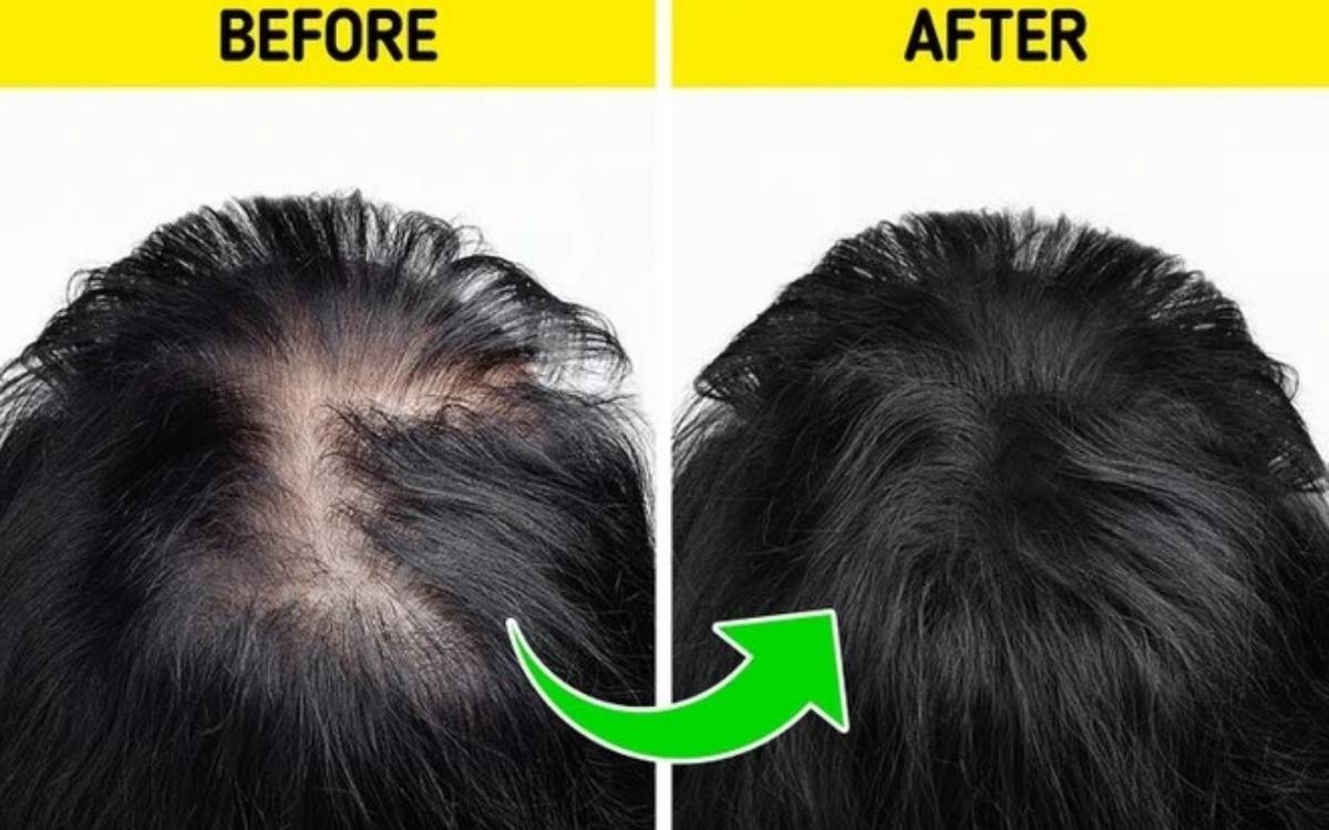 Có nên sử dụng dầu gội hỗ trợ mọc tóc