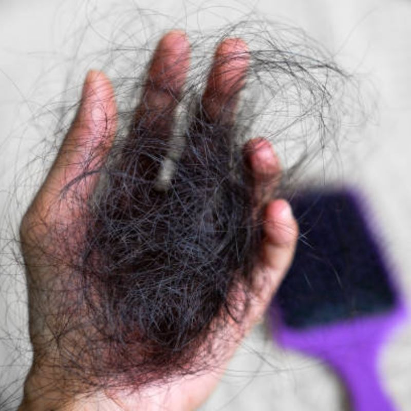 Có nhiều nguyên nhân dẫn đến rụng tóc