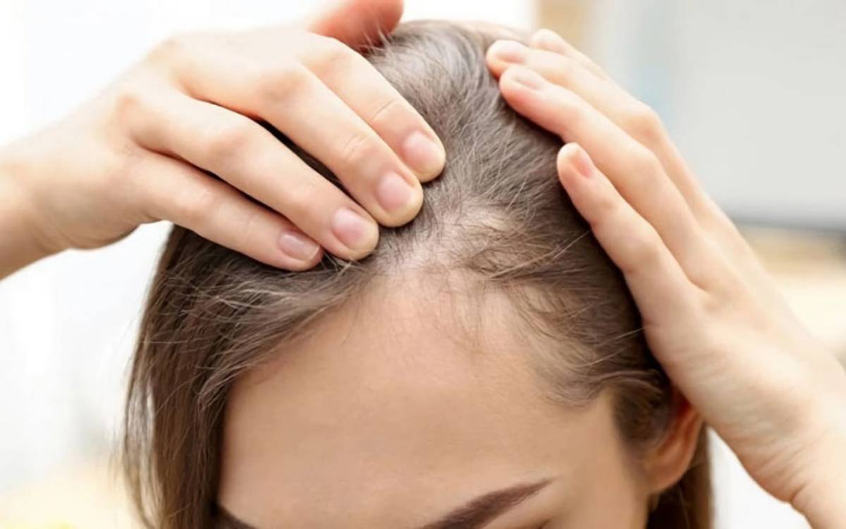 Có nhiều nguyên nhân dẫn đến tóc bị mỏng và yếu