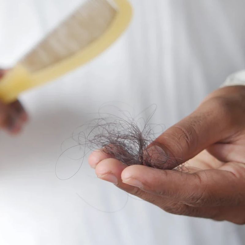 Căng thẳng có thể dẫn đến rụng tóc