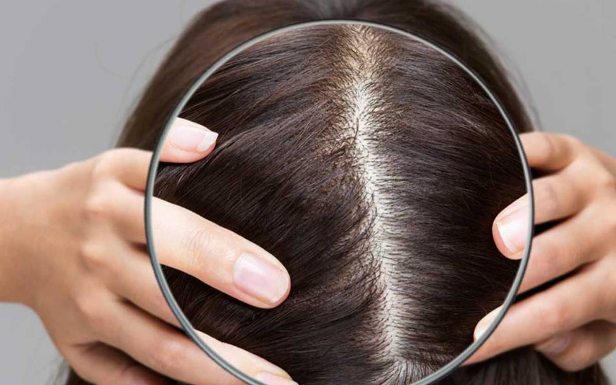 Da đầu cần được làm sạch để có mái tóc khoẻ mạnh