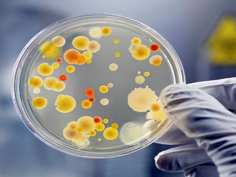 Nghiên cứu sản xuất protein tơ nhện từ việc nuôi cấy vi khuẩn E.coli