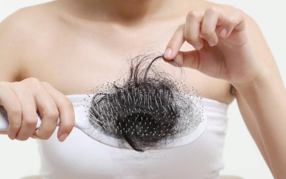 Rất nhiều người đang mắc phải tình trạng rụng tóc