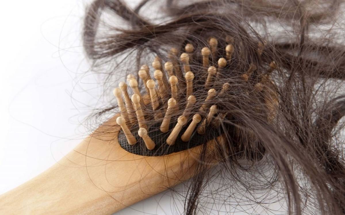 Rụng tóc sau sinh là tình trạng khá phổ biến
