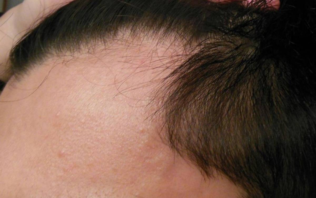 Tóc yếu thường có những dấu hiệu dễ nhận biết